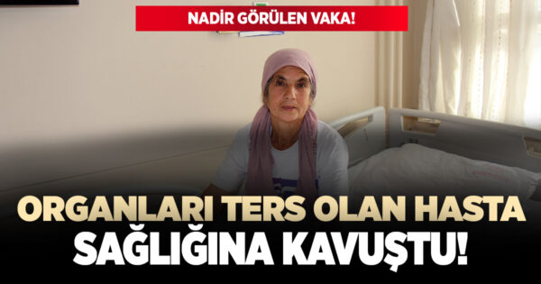 İç organları ters olan hasta sağlığına kavuştu