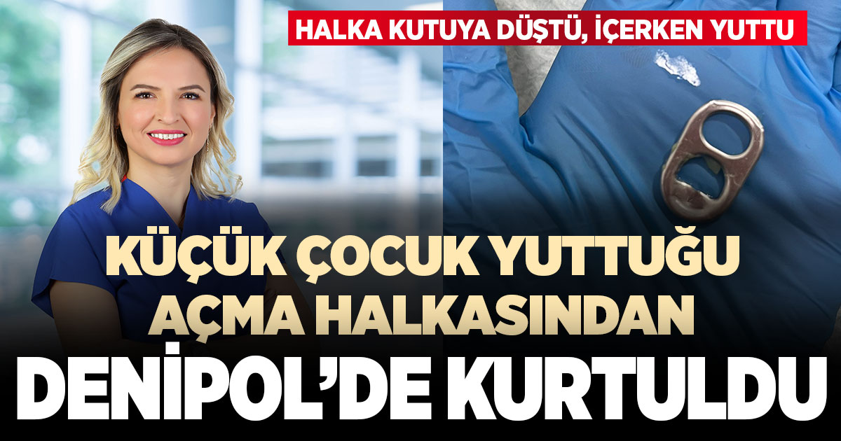 Açma halkasını yutan küçük kız, Denipol’de yapılan başarılı operasyonla sağlığına kavuştu