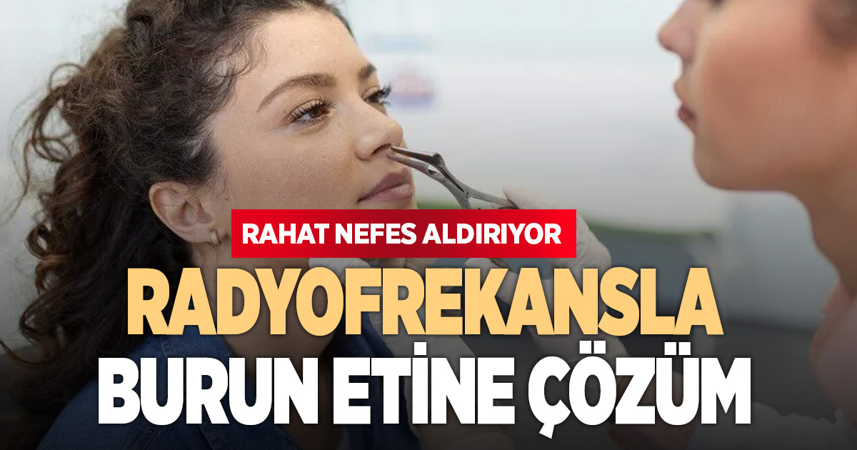 Burun eti sorununa radyo frekansla etkili çözüm
