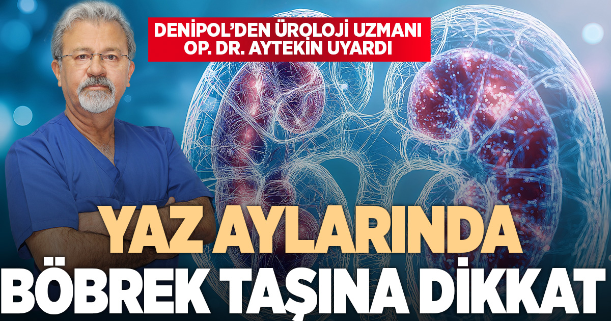 Uzmanından uyarı: Yaz aylarında böbrek taşına dikkat!