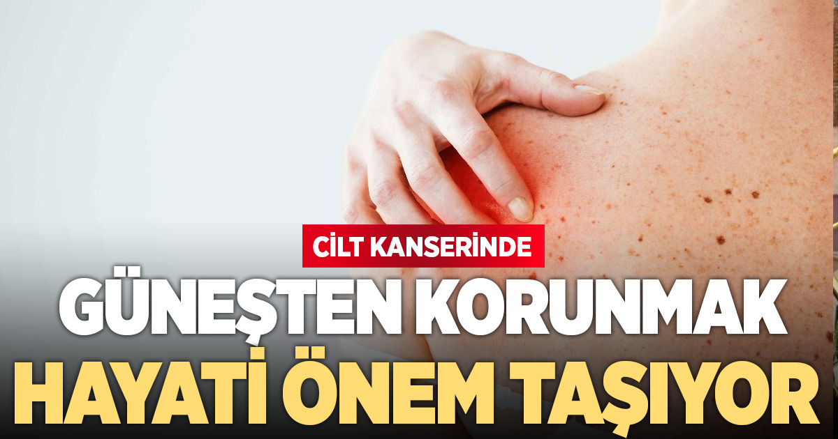 Cilt kanserine karşı güneşten korunmak önem taşıyor