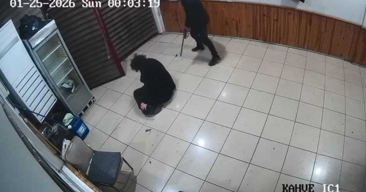Boşanma aşamasındaki eşi tarafından vurulan kadın bir bacağını kaybetti